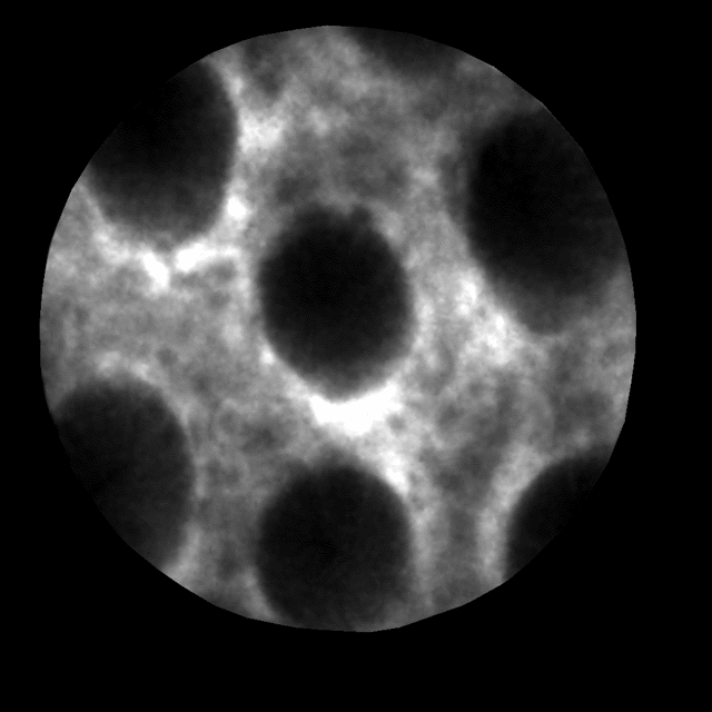 clearvue是什么独墅SHOW ｜  光学诊断新势力，攻破顶尖“扫癌利器”_https://www.jmylbn.com_新闻资讯_第8张