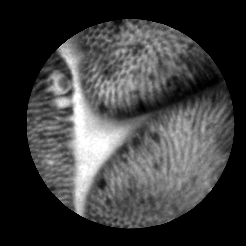 clearvue是什么独墅SHOW ｜  光学诊断新势力，攻破顶尖“扫癌利器”_https://www.jmylbn.com_新闻资讯_第7张