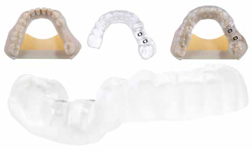 真色彩、高產能，J5 DentaJet滿足牙科設備定制化批量生產需求的圖5