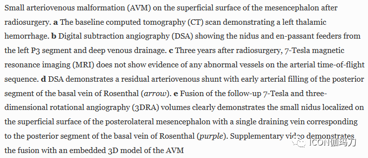 病理切片快递怎么包装【文献快递】先进的三维DSA和MRI／CT融合在神经血管病理中的价值_https://www.jmylbn.com_新闻资讯_第7张