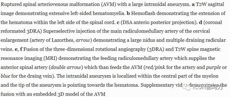 病理切片快递怎么包装【文献快递】先进的三维DSA和MRI／CT融合在神经血管病理中的价值_https://www.jmylbn.com_新闻资讯_第5张