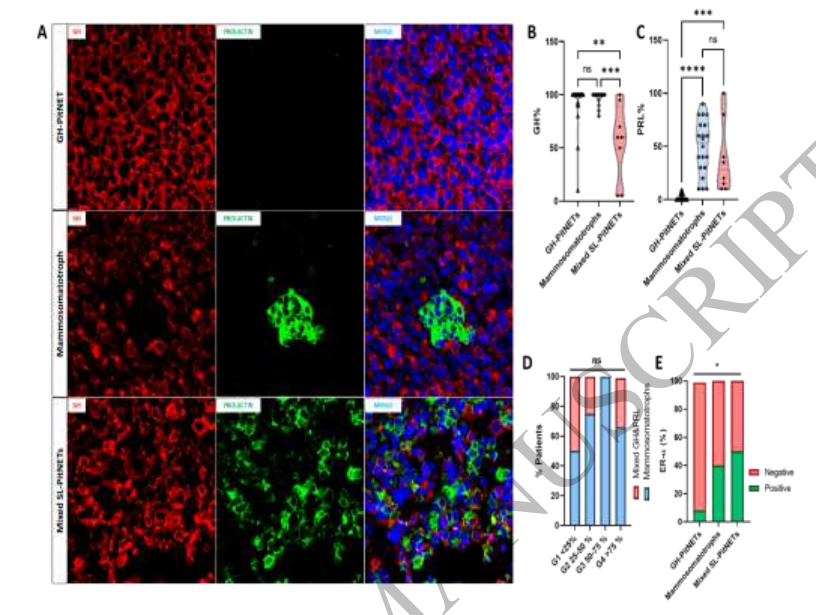 病理切片快递怎么包装【文献快递】肢端肥大症的临床和病理谱：区分GH-PitNETs、泌乳素生长激素细胞瘤和混合性生长激素泌乳素细胞瘤_https://www.jmylbn.com_新闻资讯_第7张