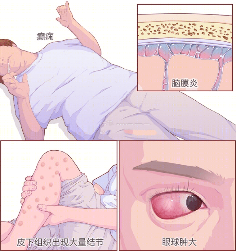 为何牛肉可以吃三五七分熟，猪肉却不可以？ 第3张