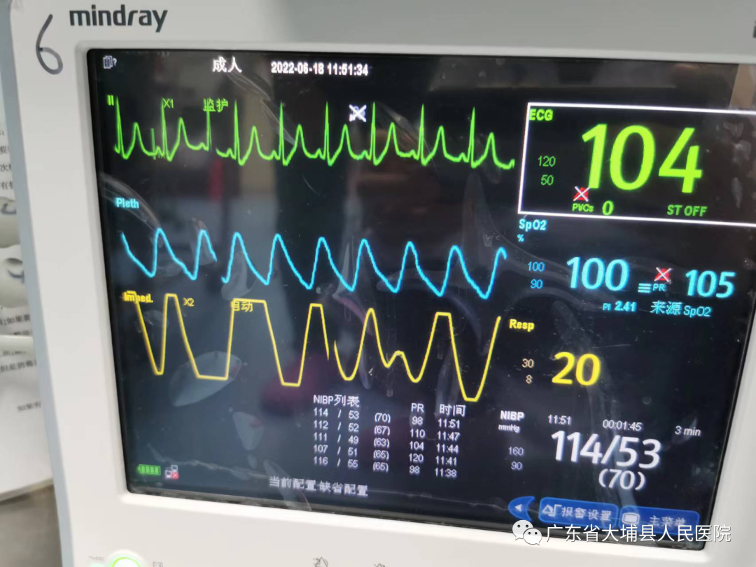 妇科填塞器怎么拿出【小球囊大作用】大埔县人民医院产科成功开展宫腔止血球囊填塞术，高效抢救产后出血_https://www.jmylbn.com_新闻资讯_第2张