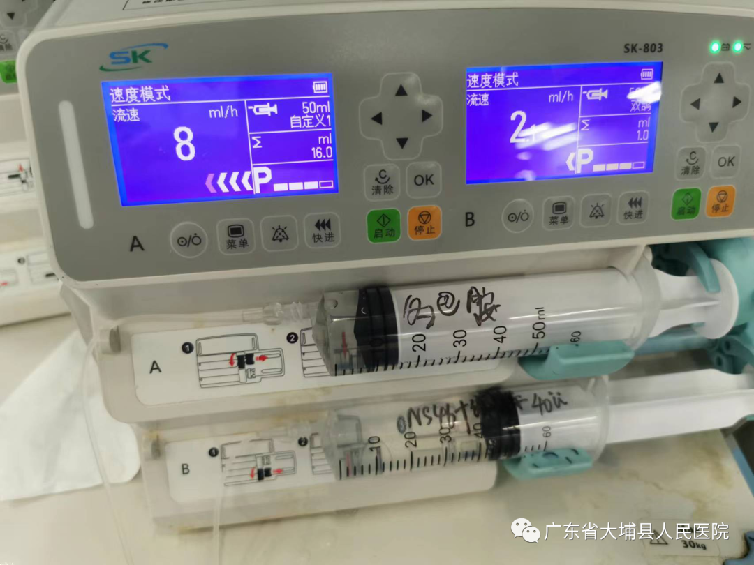 妇科填塞器怎么拿出【小球囊大作用】大埔县人民医院产科成功开展宫腔止血球囊填塞术，高效抢救产后出血_https://www.jmylbn.com_新闻资讯_第3张