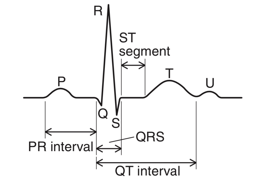 p心电图功能怎么开通心电图的P、T、QRS、U名称是怎么来的？_https://www.jmylbn.com_新闻资讯_第1张