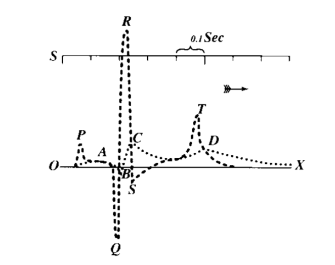 p心电图功能怎么开通心电图的P、T、QRS、U名称是怎么来的？_https://www.jmylbn.com_新闻资讯_第3张