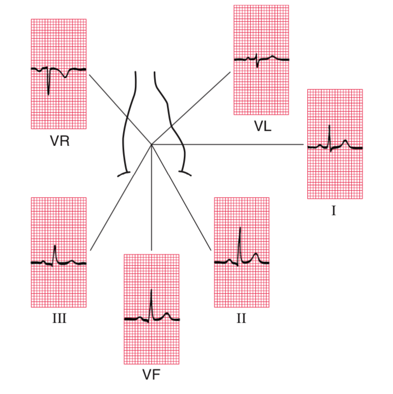 p心电图功能怎么开通心电图的P、T、QRS、U名称是怎么来的？_https://www.jmylbn.com_新闻资讯_第6张