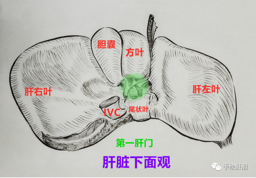 第一肝門:肝外膽道走行於肝十二指腸韌帶,上連肝臟,下接胰腺,上肝下胰