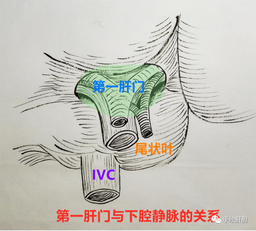 第三肝门立体图片图片