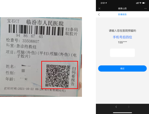 怎么安装DR胶片我院CT、核磁、DR取片服务有了新举措_https://www.jmylbn.com_新闻资讯_第8张