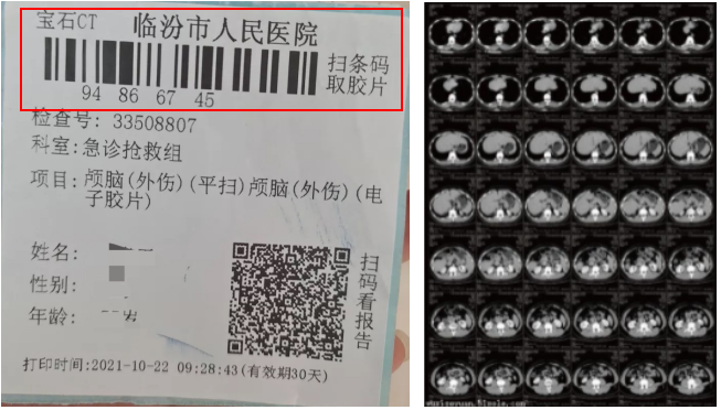 怎么安装DR胶片我院CT、核磁、DR取片服务有了新举措_https://www.jmylbn.com_新闻资讯_第3张