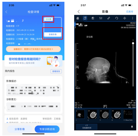 怎么安装DR胶片我院CT、核磁、DR取片服务有了新举措_https://www.jmylbn.com_新闻资讯_第9张