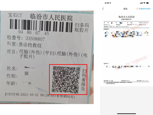 怎么安装DR胶片我院CT、核磁、DR取片服务有了新举措_https://www.jmylbn.com_新闻资讯_第4张