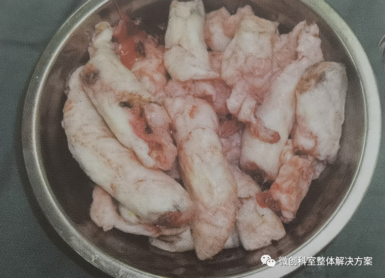 妇科器械怎么使用【妇科腹腔镜篇】常用操作器械_https://www.jmylbn.com_新闻资讯_第14张