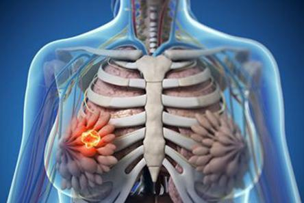 乳腺机为什么叫钼靶设备上新｜简医全新乳腺钼靶机投入使用，哪些女性应该做乳腺筛查呢_https://www.jmylbn.com_新闻资讯_第2张