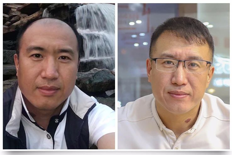 遗传性脱发13年，哈市一“的哥”这次的选择改变真大，值得脱发人群看看！