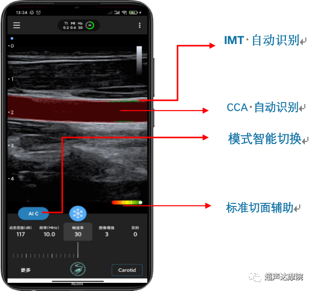 索诺星超声怎么样掌上超声新时代，来看看哪些是主流？_https://www.jmylbn.com_新闻资讯_第6张