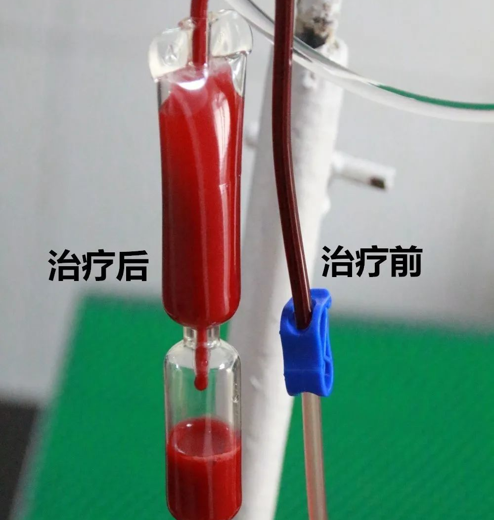 体外短波治疗什么健康专栏 ｜ 好消息，我院疼痛科新引进体外短波治疗仪，急性、慢性顽固性疼痛患者的福音！_https://www.jmylbn.com_新闻资讯_第15张