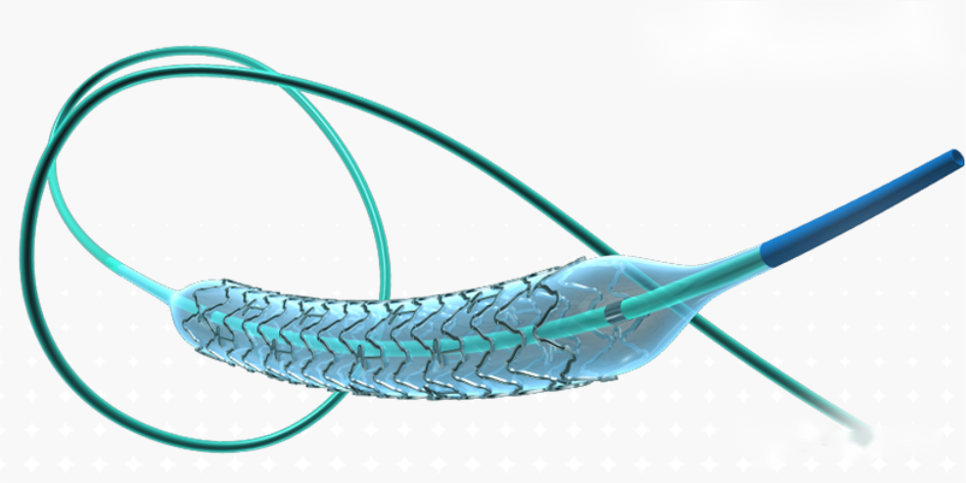 乐普心脏支架怎么样行业研究｜一文了解冠脉支架的前世今生_https://www.jmylbn.com_新闻资讯_第5张