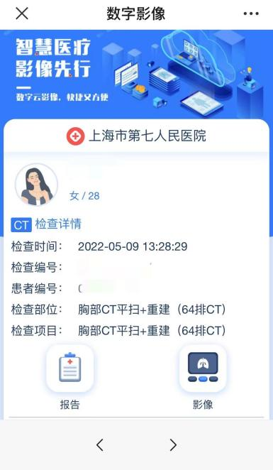 为什么x光片用胶片将X光片“装进”手机里_https://www.jmylbn.com_新闻资讯_第3张