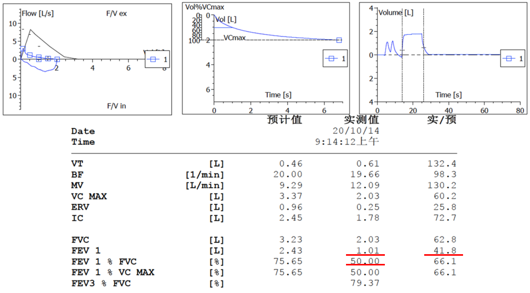 abp在医学是什么意思美例新声病例分享 ｜ 复发活动性变应性支气管肺曲霉病（ABPA）咳嗽患者诊治经验分享_https://www.jmylbn.com_新闻资讯_第9张