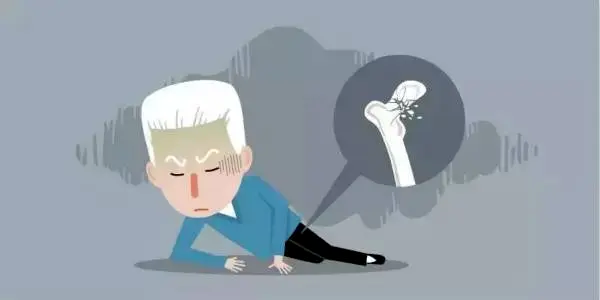 双能x骨密度检测仪为什么非得输入体重身高【医疗设备专题（八）】“双能X线全身骨密度检测仪”——骨质疏松患者的福音_https://www.jmylbn.com_新闻资讯_第7张