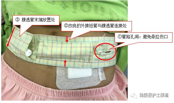 为什么要加热输血儿科护士发明家又有创新了！小发明，大作用！快来围观呀！_https://www.jmylbn.com_新闻资讯_第6张