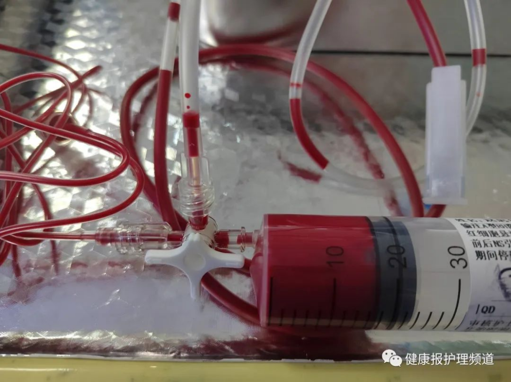 为什么要加热输血儿科护士发明家又有创新了！小发明，大作用！快来围观呀！_https://www.jmylbn.com_新闻资讯_第2张