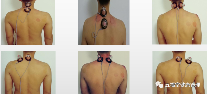 经络治疗仪什么牌子好五福堂：第九代微电脑脉冲治疗仪+新一代经络穴位手，专治颈肩腰腿痛！！！_https://www.jmylbn.com_新闻资讯_第14张