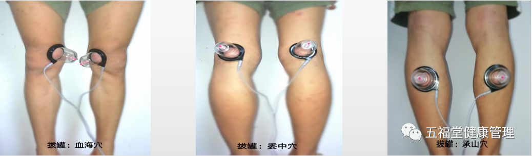 经络治疗仪什么牌子好五福堂：第九代微电脑脉冲治疗仪+新一代经络穴位手，专治颈肩腰腿痛！！！_https://www.jmylbn.com_新闻资讯_第15张