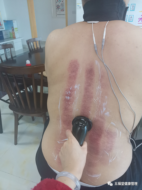 经络治疗仪什么牌子好五福堂：第九代微电脑脉冲治疗仪+新一代经络穴位手，专治颈肩腰腿痛！！！_https://www.jmylbn.com_新闻资讯_第21张