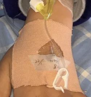 留置针怎么贴胶带医用透气胶带在儿科留置针中的使用_https://www.jmylbn.com_新闻资讯_第7张