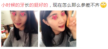 别再问20、30、40岁能不能整牙了，看完这篇就明白！