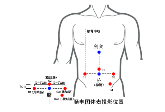 肠电图能查看什么孩子厌食、反复腹痛、便秘，不愿做胃肠镜？试试胃肠电图_https://www.jmylbn.com_新闻资讯_第10张