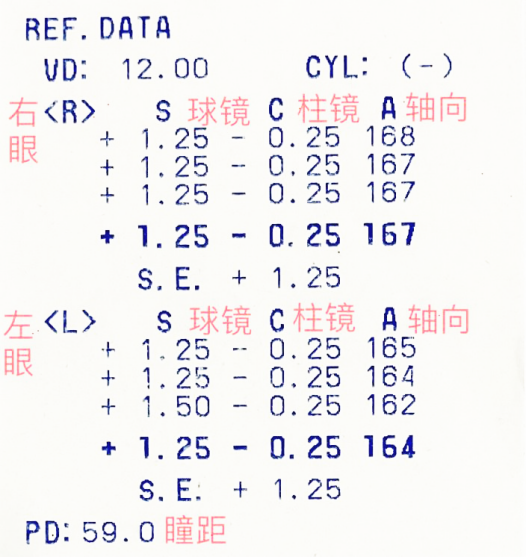儿童保健电脑怎么用【科普】关于视力检查单的几个误区，你中招了吗？_https://www.jmylbn.com_新闻资讯_第4张