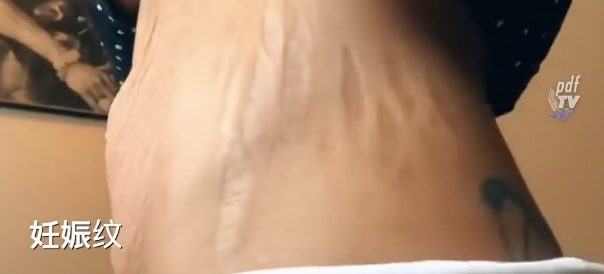 “在产房散步阴道里滴着血；我的8张私密裸照， 被老公发在了朋友圈！”做一个产妇真的太难了…（视频/组图） - 15
