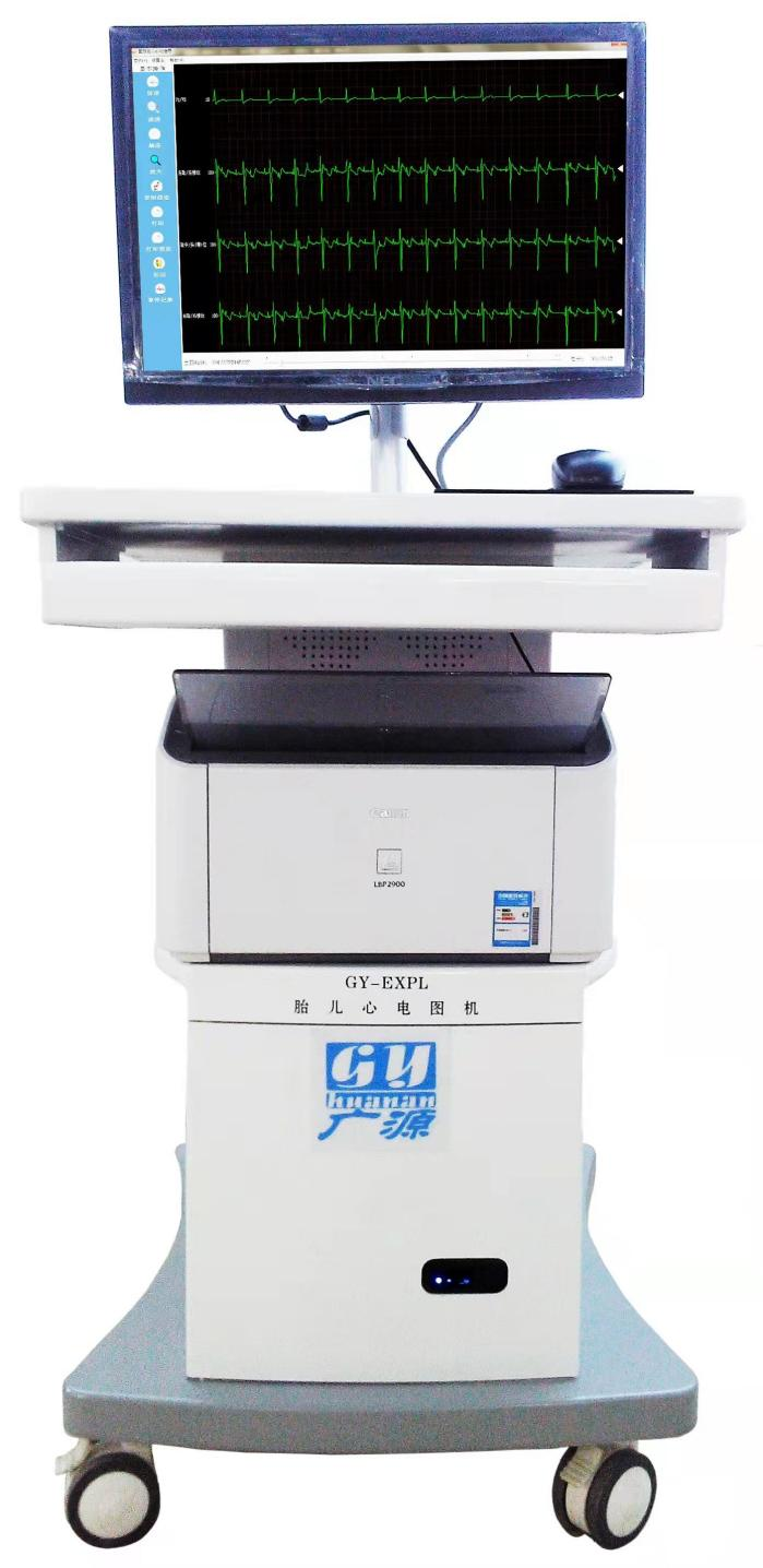 胎儿超声心电图是什么胎儿也能做心电图检查啦！_https://www.jmylbn.com_新闻资讯_第5张