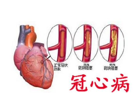 原發性高血壓VS繼發性高血壓 健康 第4張