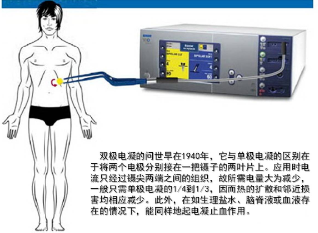 双极电凝为什么要打水双极电凝镊子，你了解多少~_https://www.jmylbn.com_新闻资讯_第2张