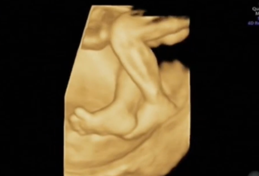 耦合剂怎么加热小举措，大温暖｜来自超声科的温暖——耦合剂恒温加热_https://www.jmylbn.com_新闻资讯_第7张