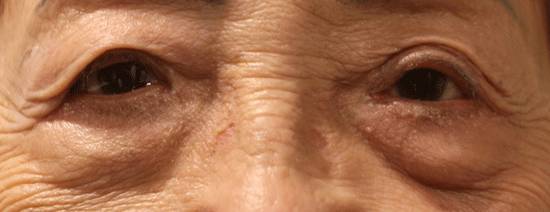 雾化美雕除皱-海南早茶美食交流组