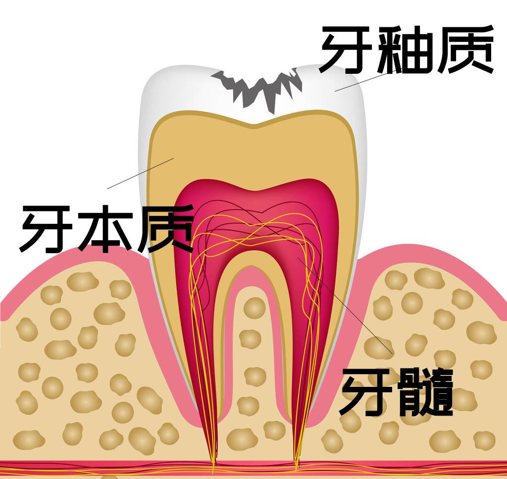 疼死還是讓牙死？下決心做根管治療咋這麼難 健康 第9張