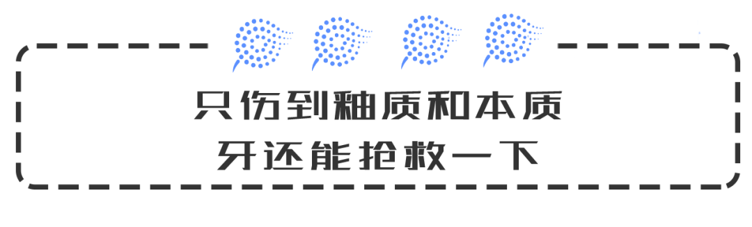 疼死還是讓牙死？下決心做根管治療咋這麼難 健康 第8張