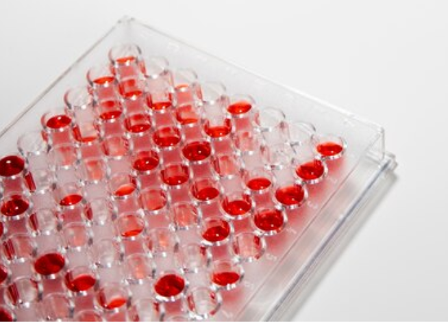 什么是辐照血血液成分科普——洗涤红细胞、辐照血液_https://www.jmylbn.com_新闻资讯_第8张