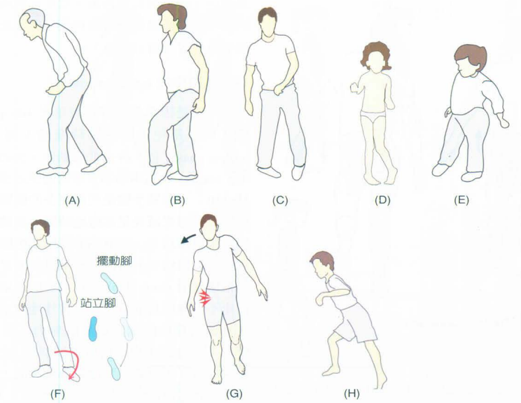步态分析上曲线怎么解读快速搞懂步态分析系列2｜如何用简单快速的方法学会步态分析？（大量丰富图表供参考）_https://www.jmylbn.com_新闻资讯_第11张