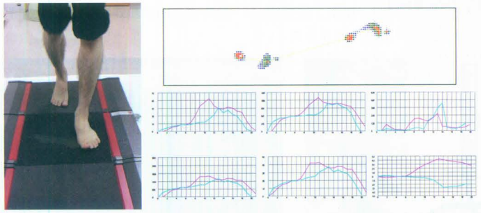 步态分析上曲线怎么解读快速搞懂步态分析系列2｜如何用简单快速的方法学会步态分析？（大量丰富图表供参考）_https://www.jmylbn.com_新闻资讯_第7张