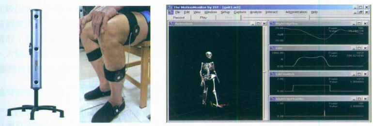 步态分析上曲线怎么解读快速搞懂步态分析系列2｜如何用简单快速的方法学会步态分析？（大量丰富图表供参考）_https://www.jmylbn.com_新闻资讯_第4张