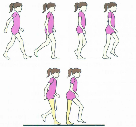 步态分析上曲线怎么解读快速搞懂步态分析系列2｜如何用简单快速的方法学会步态分析？（大量丰富图表供参考）_https://www.jmylbn.com_新闻资讯_第9张