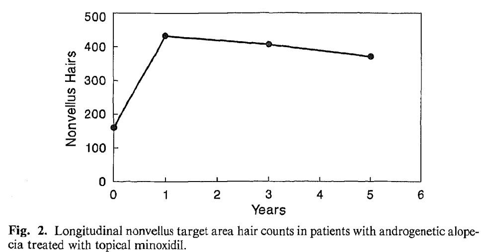 论米诺地尔的有效率和效果